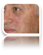 collage image title